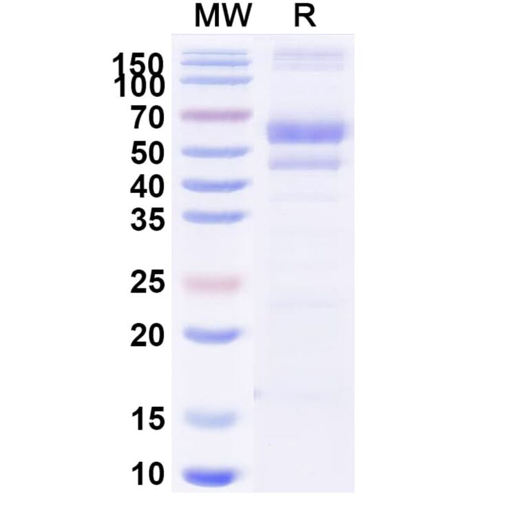 SDS-PAGE - Berahyaluronidase Alfa Biosimilar - Anti-SPAM1 Antibody - BSA and Azide free (A340502) - Antibodies.com