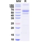 SDS-PAGE - Berahyaluronidase Alfa Biosimilar - Anti-SPAM1 Antibody - BSA and Azide free (A340502) - Antibodies.com
