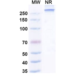 SDS-PAGE - Efzimfotase Alfa Biosimilar - Anti-ALPL Antibody - BSA and Azide free (A340504) - Antibodies.com