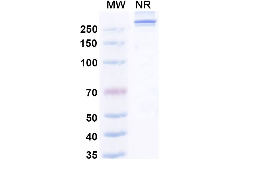 SDS-PAGE - Efzimfotase Alfa Biosimilar - Anti-ALPL Antibody - BSA and Azide free (A340504) - Antibodies.com