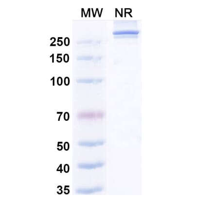 SDS-PAGE - Efzimfotase Alfa Biosimilar - Anti-ALPL Antibody - BSA and Azide free (A340504) - Antibodies.com