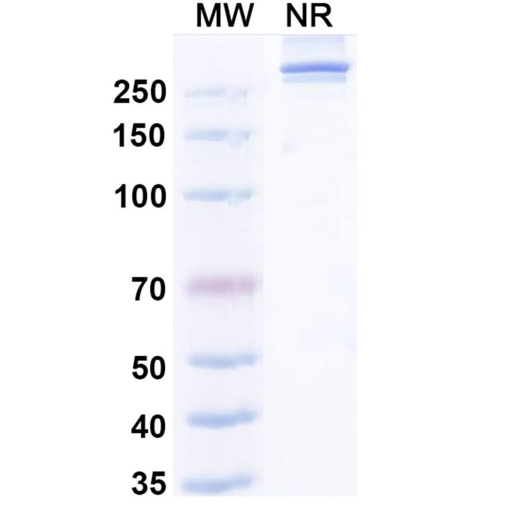 SDS-PAGE - Efzimfotase Alfa Biosimilar - Anti-ALPL Antibody - BSA and Azide free (A340504) - Antibodies.com