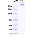 SDS-PAGE - Efzimfotase Alfa Biosimilar - Anti-ALPL Antibody - BSA and Azide free (A340504) - Antibodies.com
