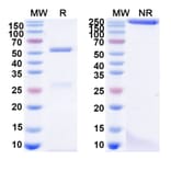 SDS-PAGE - Anti-Glycoprotein Antibody [ADI-15878] Biosimilar - BSA and Azide free (A340529) - Antibodies.com