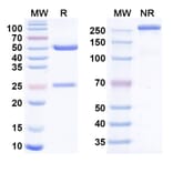 SDS-PAGE - Anti-BCMA Antibody [BCMB69] Biosimilar - BSA and Azide free (A340534) - Antibodies.com