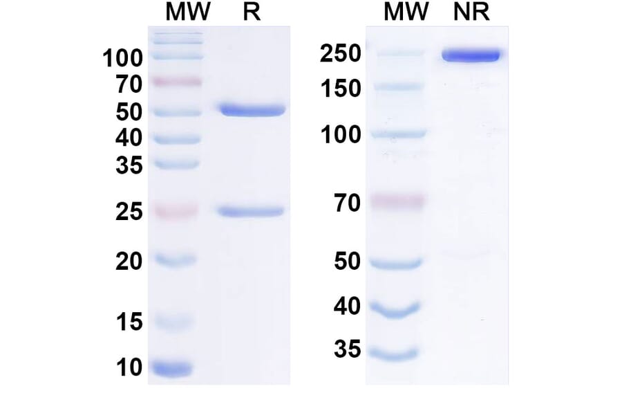SDS-PAGE - Anti-IL-31RA Antibody [NA633] Biosimilar - BSA and Azide free (A340556) - Antibodies.com