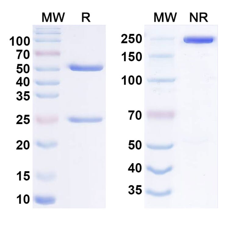 SDS-PAGE - Anti-IL-31RA Antibody [NA633] Biosimilar - BSA and Azide free (A340556) - Antibodies.com
