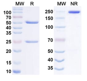 SDS-PAGE - Anti-IL-4R Antibody [12B5] Biosimilar - BSA and Azide free (A340557) - Antibodies.com