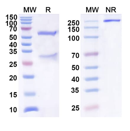 SDS-PAGE - Anti-SEZ6 Antibody [ABBV-11] Biosimilar - BSA and Azide free (A340571) - Antibodies.com