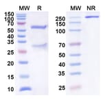 SDS-PAGE - Anti-SEZ6 Antibody [ABBV-11] Biosimilar - BSA and Azide free (A340571) - Antibodies.com