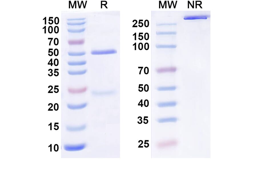 SDS-PAGE - Anti-KLB Antibody [MK-3655] Biosimilar - BSA and Azide free (A340578) - Antibodies.com