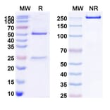 SDS-PAGE - Rituximab Biosimilar - Anti-CD20 Antibody - BSA and Azide free (A340579) - Antibodies.com