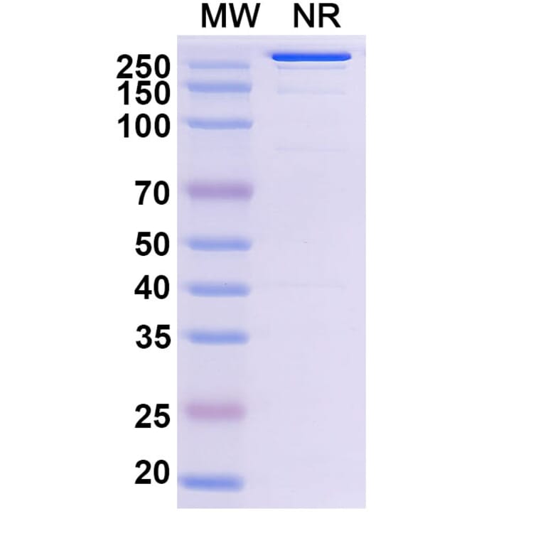 SDS-PAGE - Abiprubart Biosimilar - Anti-CD40 Antibody - BSA and Azide free (A340583) - Antibodies.com
