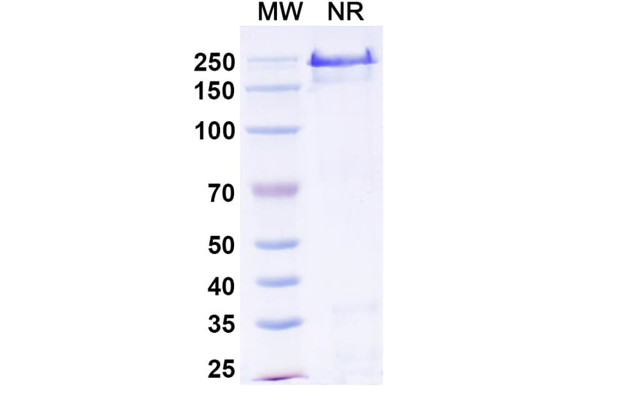 SDS-PAGE - Abiprubart Biosimilar - Anti-CD40 Antibody - BSA and Azide free (A340583) - Antibodies.com