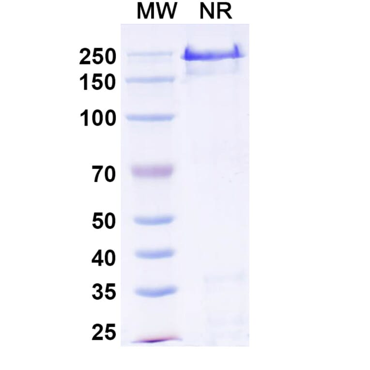 SDS-PAGE - Abiprubart Biosimilar - Anti-CD40 Antibody - BSA and Azide free (A340583) - Antibodies.com