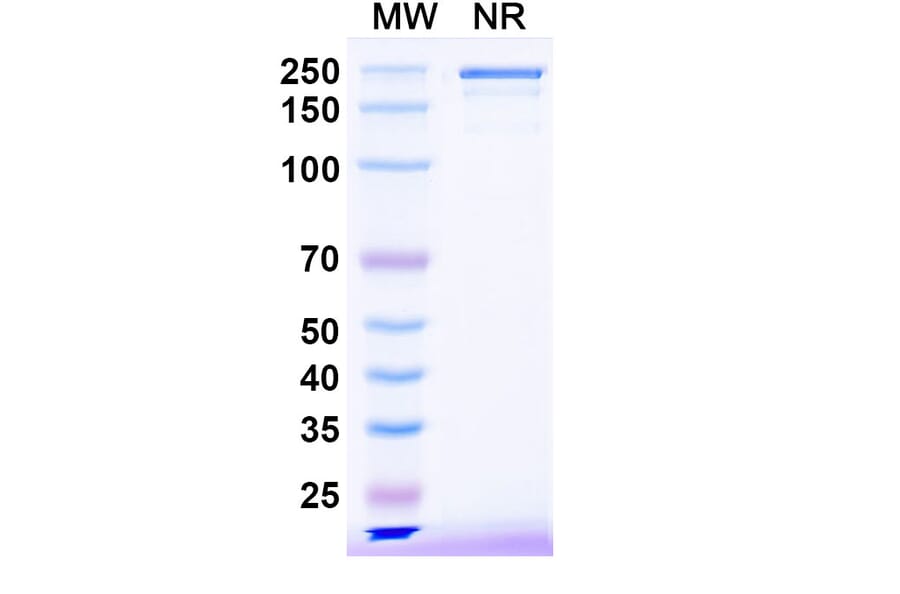 SDS-PAGE - Bezetabart Biosimilar - Anti-CD74 Antibody - BSA and Azide free (A340585) - Antibodies.com