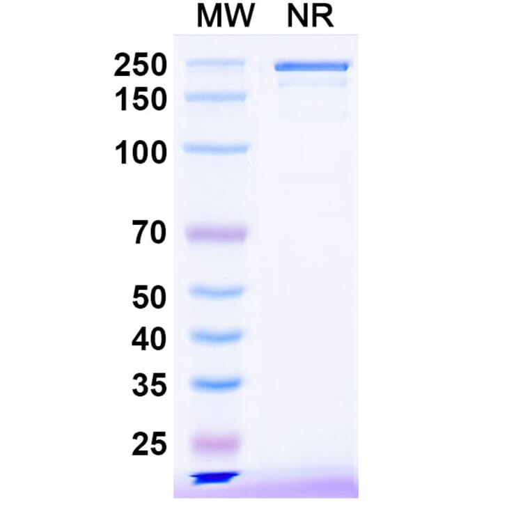 SDS-PAGE - Bezetabart Biosimilar - Anti-CD74 Antibody - BSA and Azide free (A340585) - Antibodies.com