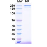 SDS-PAGE - Bezetabart Biosimilar - Anti-CD74 Antibody - BSA and Azide free (A340585) - Antibodies.com
