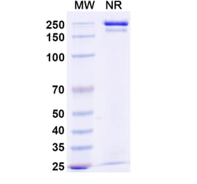 SDS-PAGE - Budoprutug Biosimilar - Anti-CD19 Antibody - BSA and Azide free (A340586) - Antibodies.com