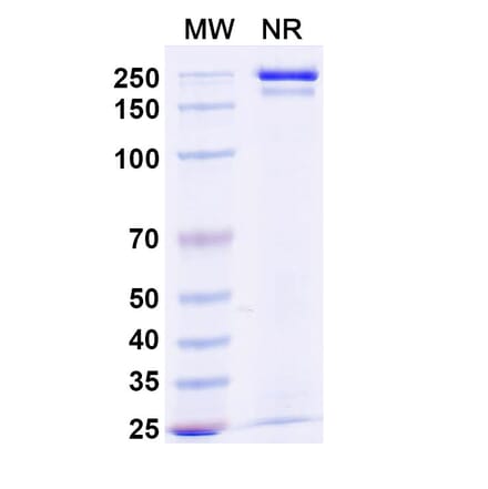 SDS-PAGE - Budoprutug Biosimilar - Anti-CD19 Antibody - BSA and Azide free (A340586) - Antibodies.com