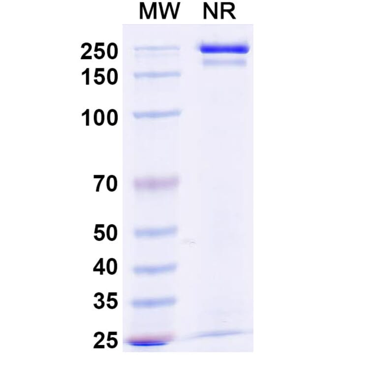SDS-PAGE - Budoprutug Biosimilar - Anti-CD19 Antibody - BSA and Azide free (A340586) - Antibodies.com