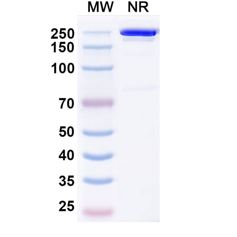 SDS-PAGE - Budoprutug Biosimilar - Anti-CD19 Antibody - BSA and Azide free (A340586) - Antibodies.com