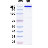SDS-PAGE - Budoprutug Biosimilar - Anti-CD19 Antibody - BSA and Azide free (A340586) - Antibodies.com