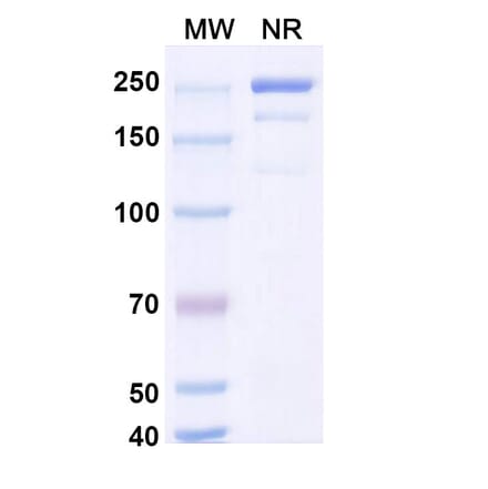 SDS-PAGE - Coramitug Biosimilar - Anti-ATTR Antibody - BSA and Azide free (A340589) - Antibodies.com