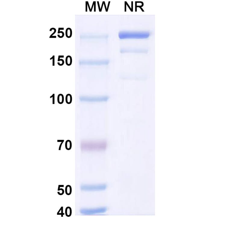 SDS-PAGE - Coramitug Biosimilar - Anti-ATTR Antibody - BSA and Azide free (A340589) - Antibodies.com
