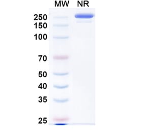 SDS-PAGE - Evalstotug Biosimilar - Anti-CTLA-4 Antibody - BSA and Azide free (A340593) - Antibodies.com