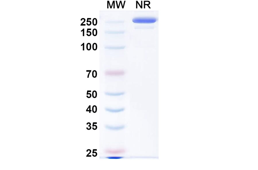 SDS-PAGE - Evalstotug Biosimilar - Anti-CTLA-4 Antibody - BSA and Azide free (A340593) - Antibodies.com