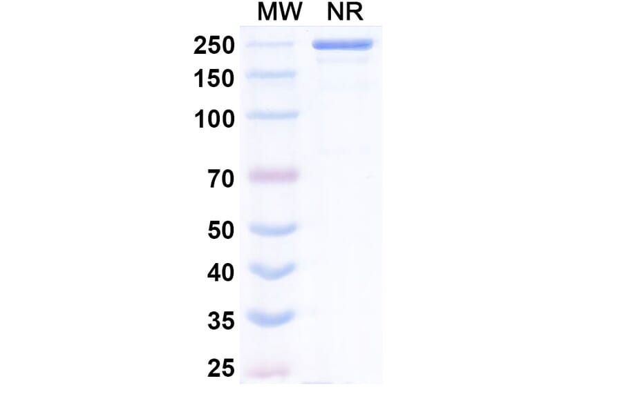 SDS-PAGE - Evalstotug Biosimilar - Anti-CTLA-4 Antibody - BSA and Azide free (A340593) - Antibodies.com