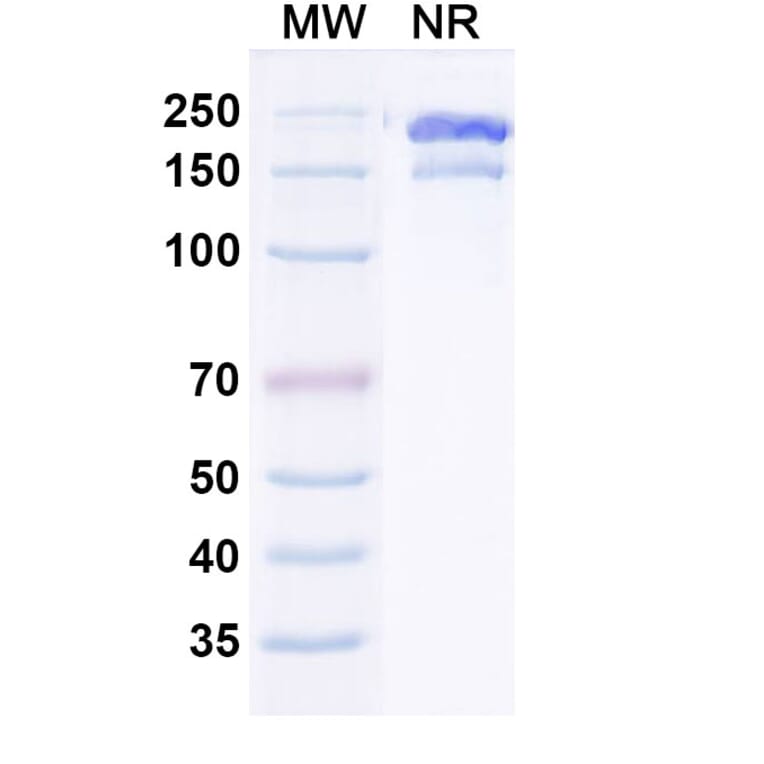 SDS-PAGE - Gruticibart Biosimilar - Anti-Factor XI Antibody - BSA and Azide free (A340597) - Antibodies.com