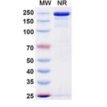 SDS-PAGE - Gruticibart Biosimilar - Anti-Factor XI Antibody - BSA and Azide free (A340597) - Antibodies.com