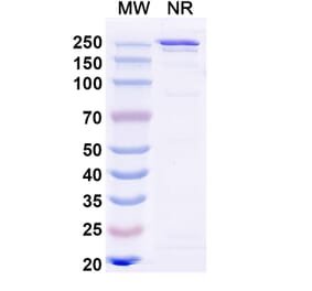 SDS-PAGE - Ibentatug Biosimilar - Anti-Plectin Antibody - BSA and Azide free (A340598) - Antibodies.com