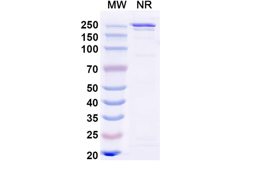 SDS-PAGE - Ibentatug Biosimilar - Anti-Plectin Antibody - BSA and Azide free (A340598) - Antibodies.com