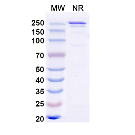 SDS-PAGE - Ibentatug Biosimilar - Anti-Plectin Antibody - BSA and Azide free (A340598) - Antibodies.com