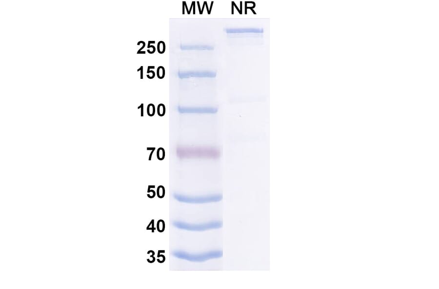 SDS-PAGE - Ibentatug Biosimilar - Anti-Plectin Antibody - BSA and Azide free (A340598) - Antibodies.com