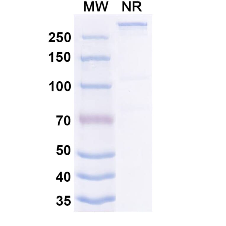 SDS-PAGE - Ibentatug Biosimilar - Anti-Plectin Antibody - BSA and Azide free (A340598) - Antibodies.com