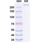SDS-PAGE - Ibentatug Biosimilar - Anti-Plectin Antibody - BSA and Azide free (A340598) - Antibodies.com
