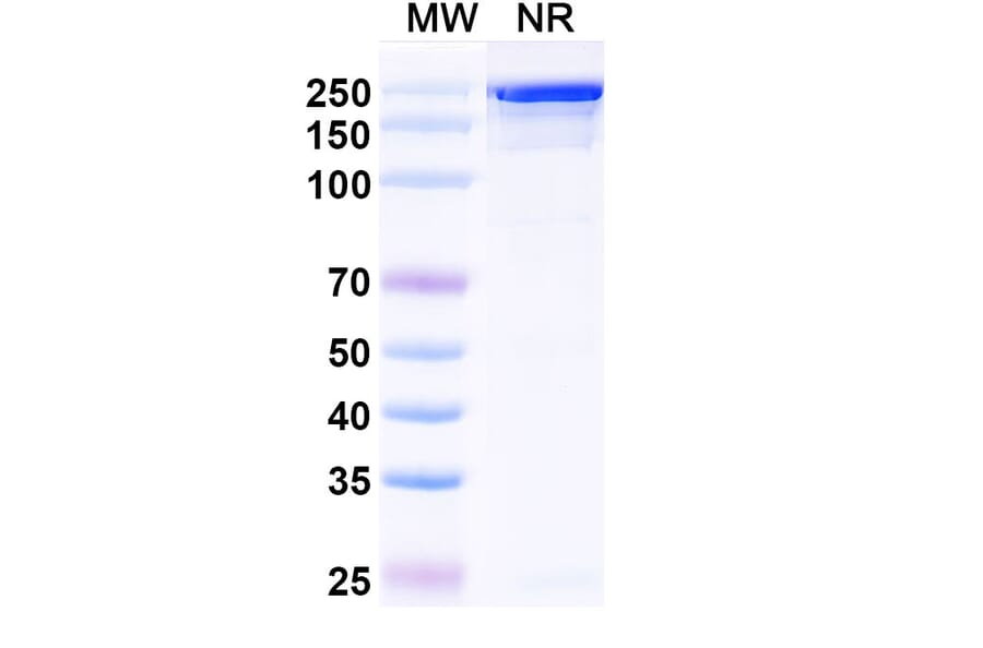 SDS-PAGE - Izastobart Biosimilar - Anti-C5aR Antibody - BSA and Azide free (A340599) - Antibodies.com