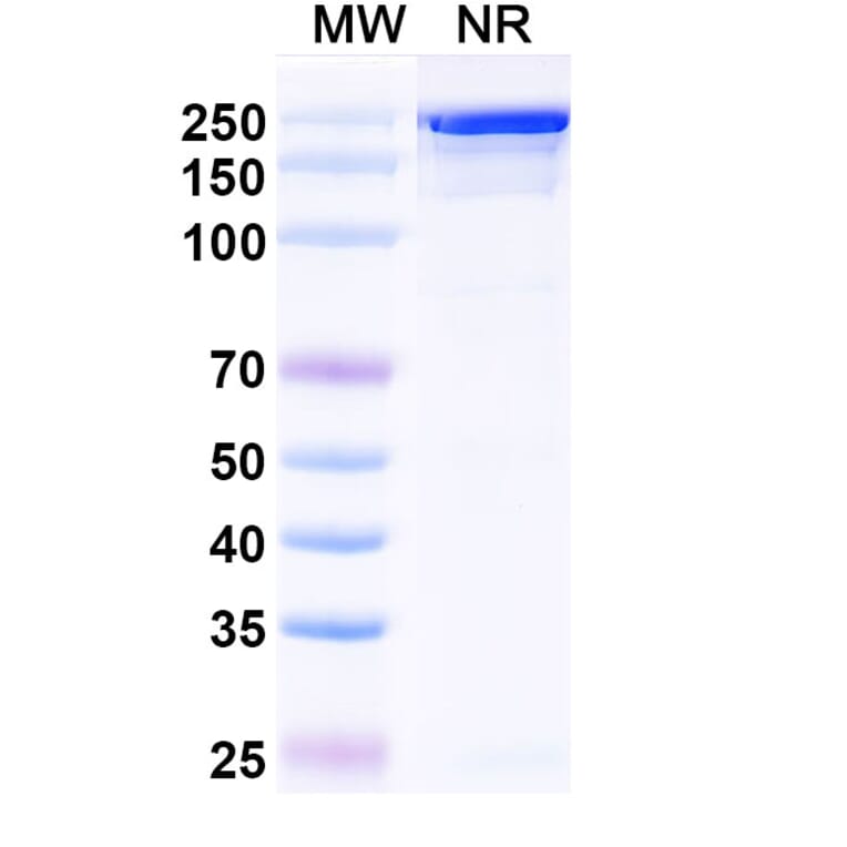 SDS-PAGE - Izastobart Biosimilar - Anti-C5aR Antibody - BSA and Azide free (A340599) - Antibodies.com