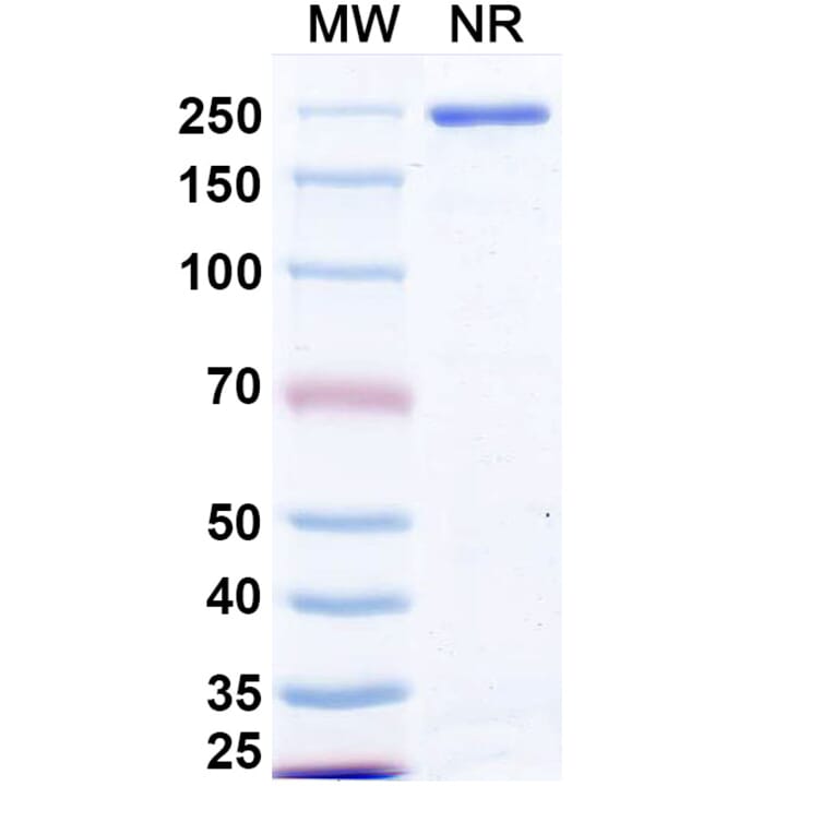 SDS-PAGE - Izastobart Biosimilar - Anti-C5aR Antibody - BSA and Azide free (A340599) - Antibodies.com