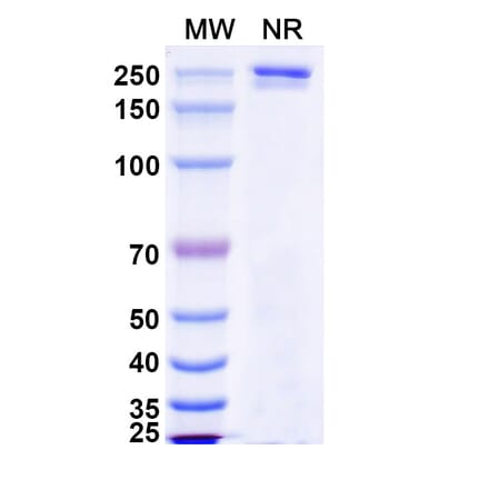 SDS-PAGE - Luvagrobart Biosimilar - Anti-NGF Antibody - BSA and Azide free (A340603) - Antibodies.com