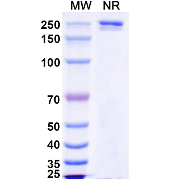 SDS-PAGE - Luvagrobart Biosimilar - Anti-NGF Antibody - BSA and Azide free (A340603) - Antibodies.com