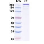SDS-PAGE - Luvagrobart Biosimilar - Anti-NGF Antibody - BSA and Azide free (A340603) - Antibodies.com
