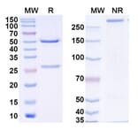 SDS-PAGE - Omoprubart Biosimilar - Anti-C5 Antibody - BSA and Azide free (A340606) - Antibodies.com