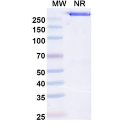 SDS-PAGE - Opelkibart Biosimilar - Anti-c-Kit Antibody - BSA and Azide free (A340607) - Antibodies.com