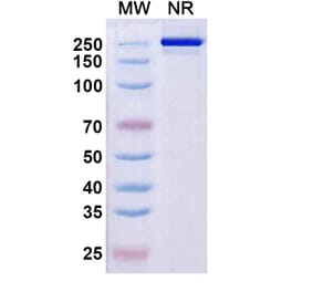 SDS-PAGE - Rezorstobart Biosimilar - Anti-CD161 Antibody - BSA and Azide free (A340612) - Antibodies.com