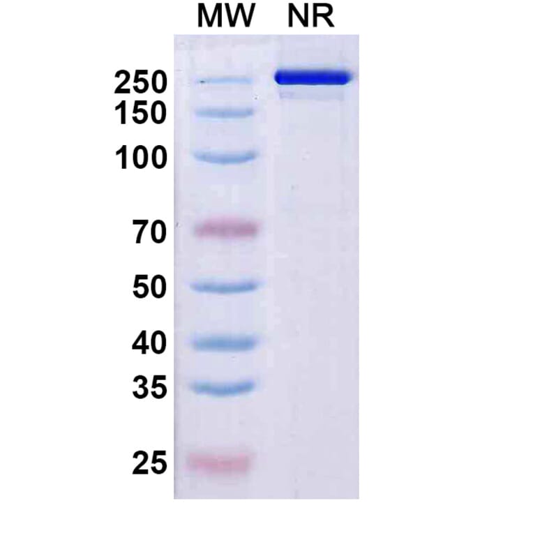 SDS-PAGE - Rezorstobart Biosimilar - Anti-CD161 Antibody - BSA and Azide free (A340612) - Antibodies.com